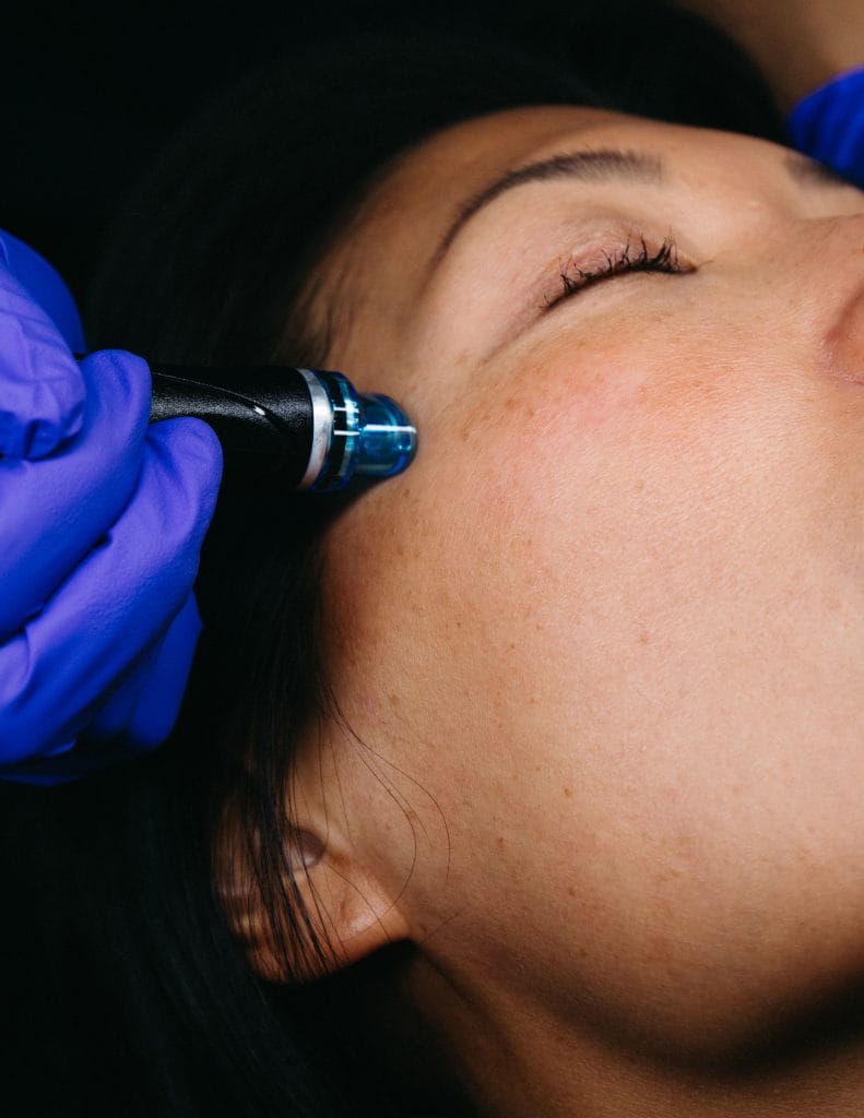 Hydrafacial
