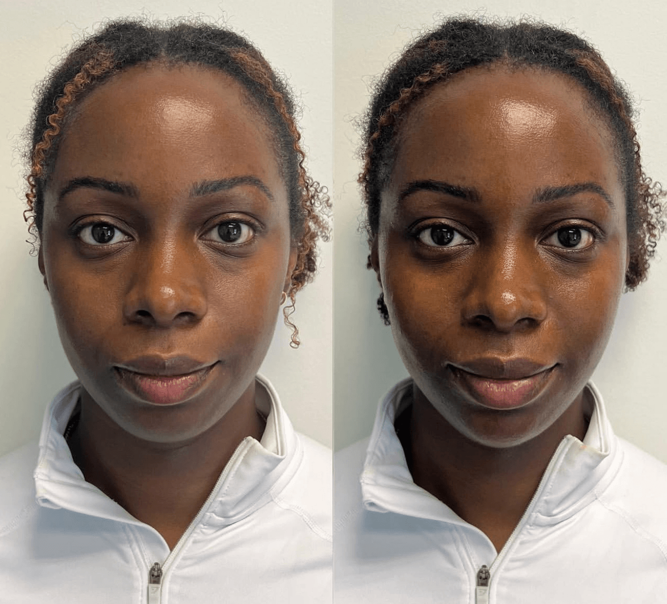 Filler 3 Untitled design 2 1